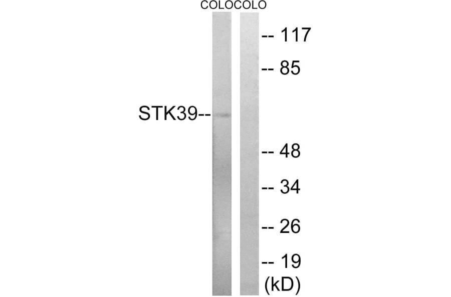 Western Blot - Anti-STK39 Antibody (B8187) - Antibodies.com