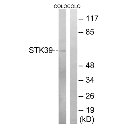 Western Blot - Anti-STK39 Antibody (B8187) - Antibodies.com
