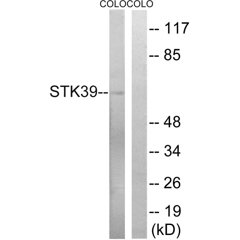 Western Blot - Anti-STK39 Antibody (B8187) - Antibodies.com
