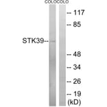 Western Blot - Anti-STK39 Antibody (B8187) - Antibodies.com