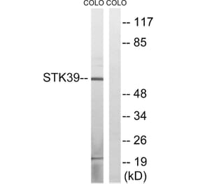 Western Blot - Anti-STK39 Antibody (B8188) - Antibodies.com