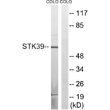 Western Blot - Anti-STK39 Antibody (B8188) - Antibodies.com