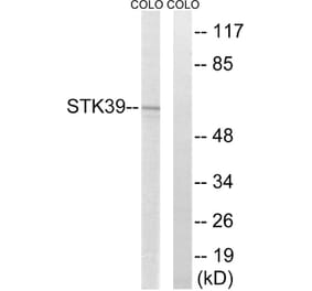 Western Blot - Anti-STK39 Antibody (C18954) - Antibodies.com