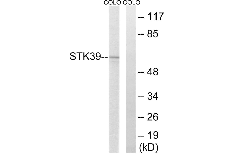 Western Blot - Anti-STK39 Antibody (C18954) - Antibodies.com