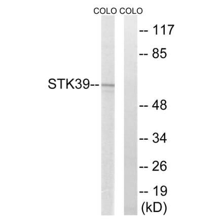Western Blot - Anti-STK39 Antibody (C18954) - Antibodies.com