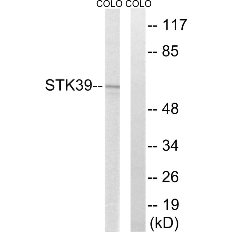 Western Blot - Anti-STK39 Antibody (C18954) - Antibodies.com
