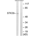Western Blot - Anti-STK39 Antibody (C18954) - Antibodies.com