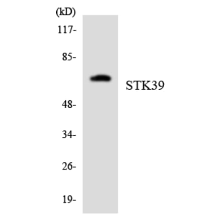 Western Blot - Anti-STK39 Antibody (R12-3571) - Antibodies.com