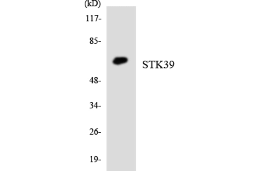 Western Blot - Anti-STK39 Antibody (R12-3572) - Antibodies.com
