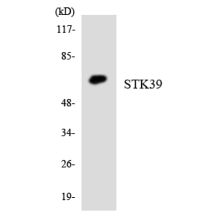 Western Blot - Anti-STK39 Antibody (R12-3572) - Antibodies.com