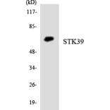 Western Blot - Anti-STK39 Antibody (R12-3572) - Antibodies.com