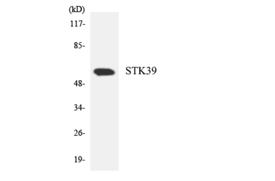 Western Blot - Anti-STK39 Antibody (R12-3573) - Antibodies.com