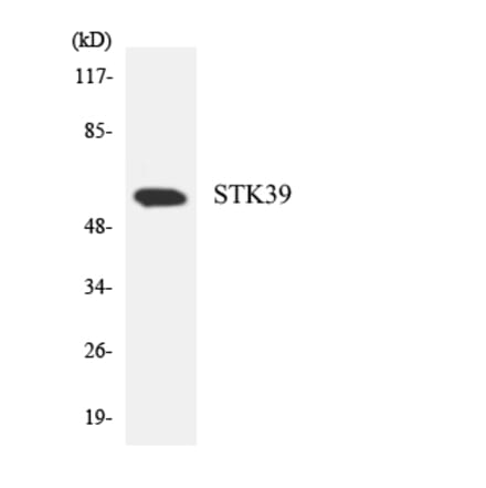 Western Blot - Anti-STK39 Antibody (R12-3573) - Antibodies.com