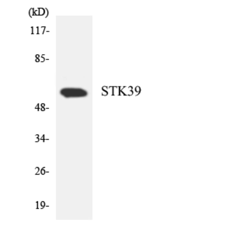 Western Blot - Anti-STK39 Antibody (R12-3573) - Antibodies.com