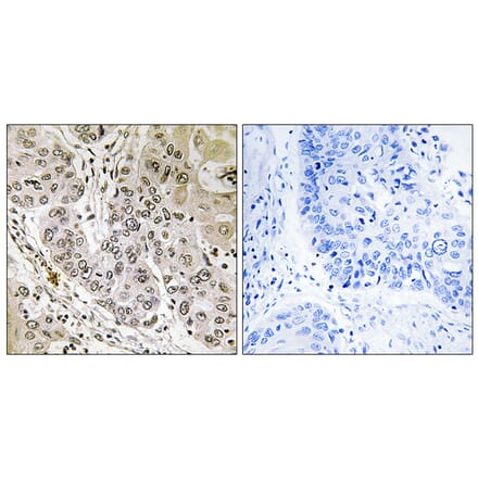 Immunohistochemistry - Anti-STK36 Antibody (C18543) - Antibodies.com