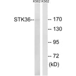 Western Blot - Anti-STK36 Antibody (C18543) - Antibodies.com