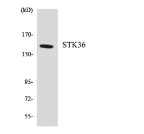 Western Blot - Anti-STK36 Antibody (R12-3570) - Antibodies.com