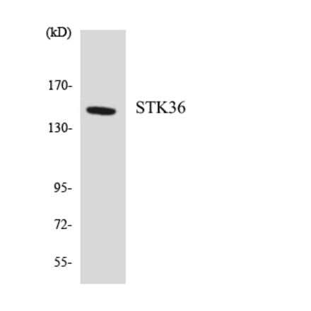 Western Blot - Anti-STK36 Antibody (R12-3570) - Antibodies.com