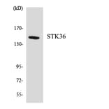Western Blot - Anti-STK36 Antibody (R12-3570) - Antibodies.com