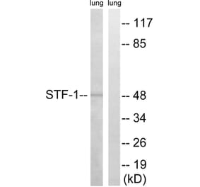 Western Blot - Anti-STF-1 Antibody (B8428) - Antibodies.com