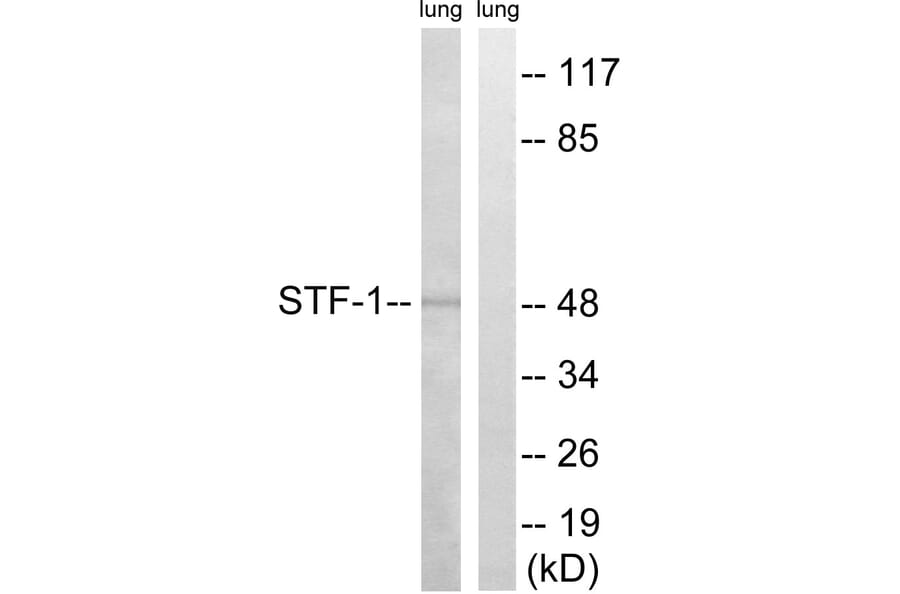 Western Blot - Anti-STF-1 Antibody (B8428) - Antibodies.com