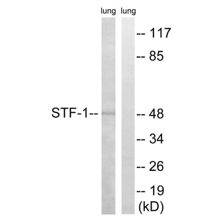 Western Blot - Anti-STF-1 Antibody (B8428) - Antibodies.com
