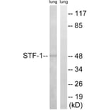 Western Blot - Anti-STF-1 Antibody (B8428) - Antibodies.com