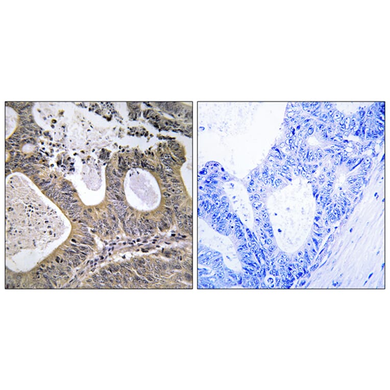 Immunohistochemistry - Anti-STEA2 Antibody (C11375) - Antibodies.com
