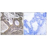 Immunohistochemistry - Anti-STEA2 Antibody (C11375) - Antibodies.com
