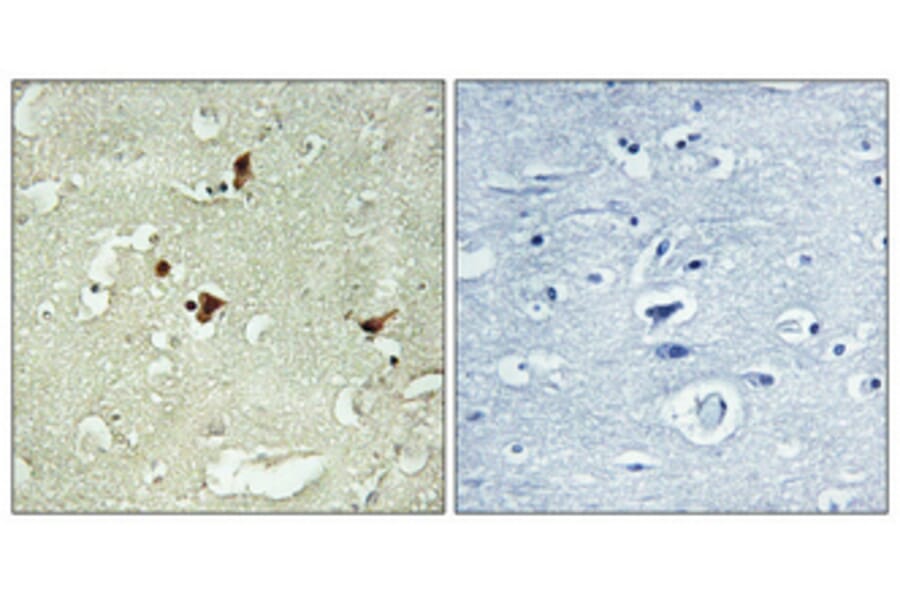 Immunohistochemistry - Anti-STAT3 Antibody (C10589) - Antibodies.com