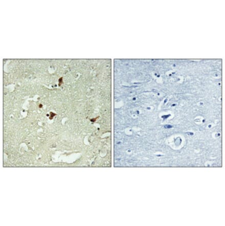 Immunohistochemistry - Anti-STAT3 Antibody (C10589) - Antibodies.com