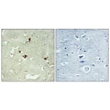 Immunohistochemistry - Anti-STAT3 Antibody (C10589) - Antibodies.com