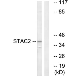 Western Blot - Anti-STAC2 Antibody (C18708) - Antibodies.com