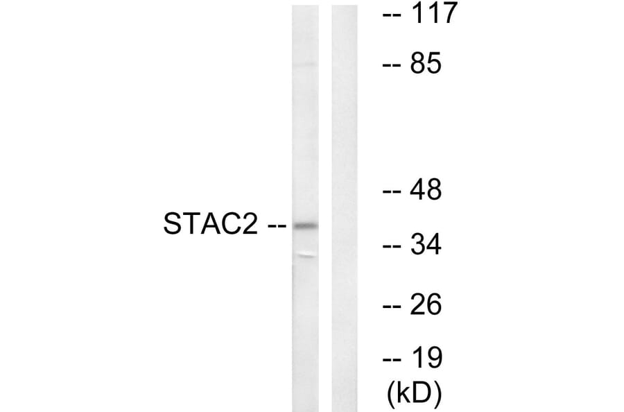 Western Blot - Anti-STAC2 Antibody (C18708) - Antibodies.com