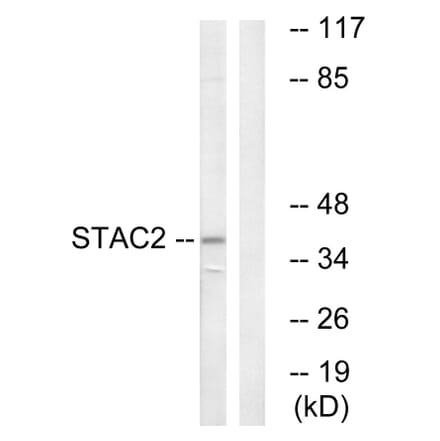 Western Blot - Anti-STAC2 Antibody (C18708) - Antibodies.com