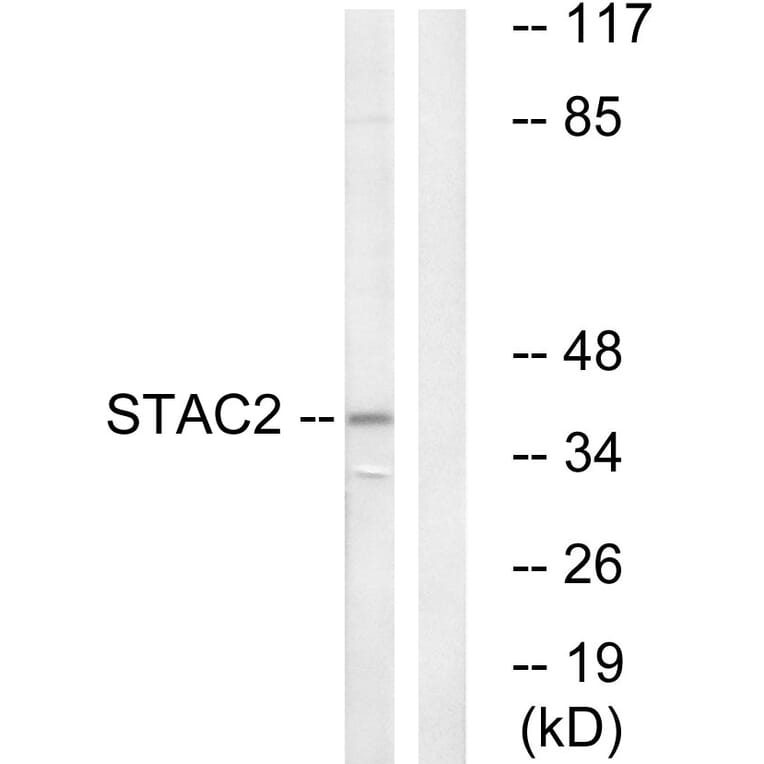 Western Blot - Anti-STAC2 Antibody (C18708) - Antibodies.com