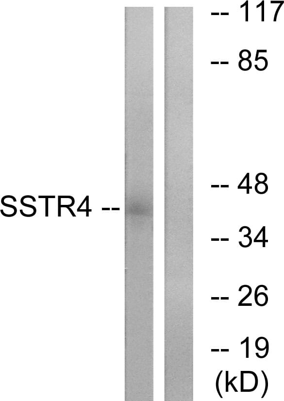 Western blot analysis of lysates from LOVO cells using Anti-SSTR4 Antibody. The right hand lane represents a negative control, where the antibody is blocked by the immunising peptide.