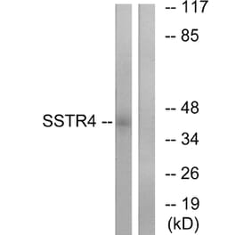 Western Blot - Anti-SSTR4 Antibody (G747) - Antibodies.com