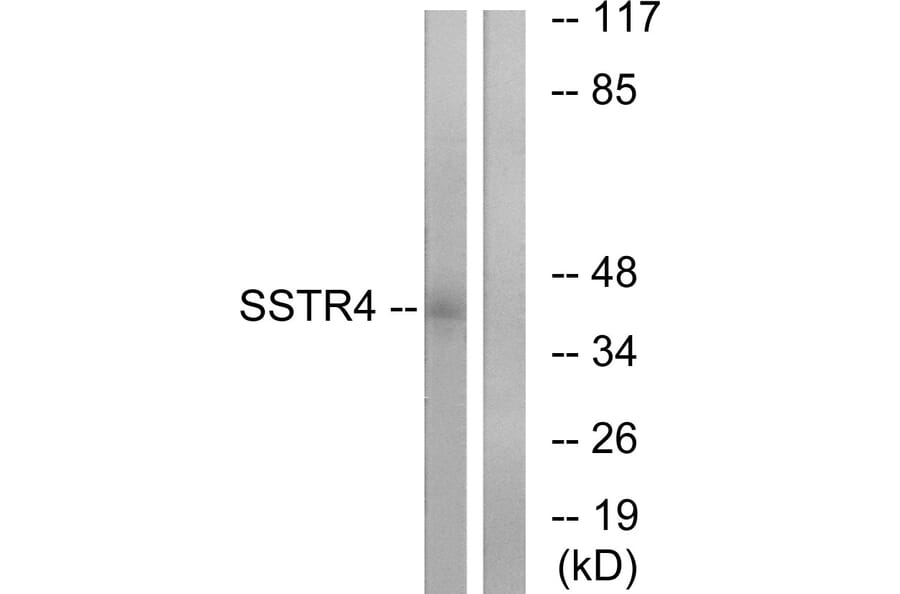 Western Blot - Anti-SSTR4 Antibody (G747) - Antibodies.com