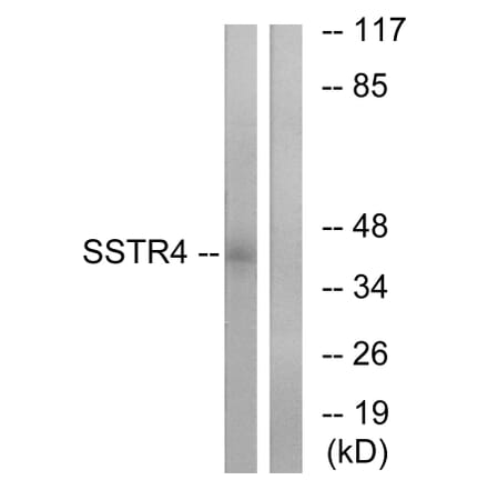 Western Blot - Anti-SSTR4 Antibody (G747) - Antibodies.com