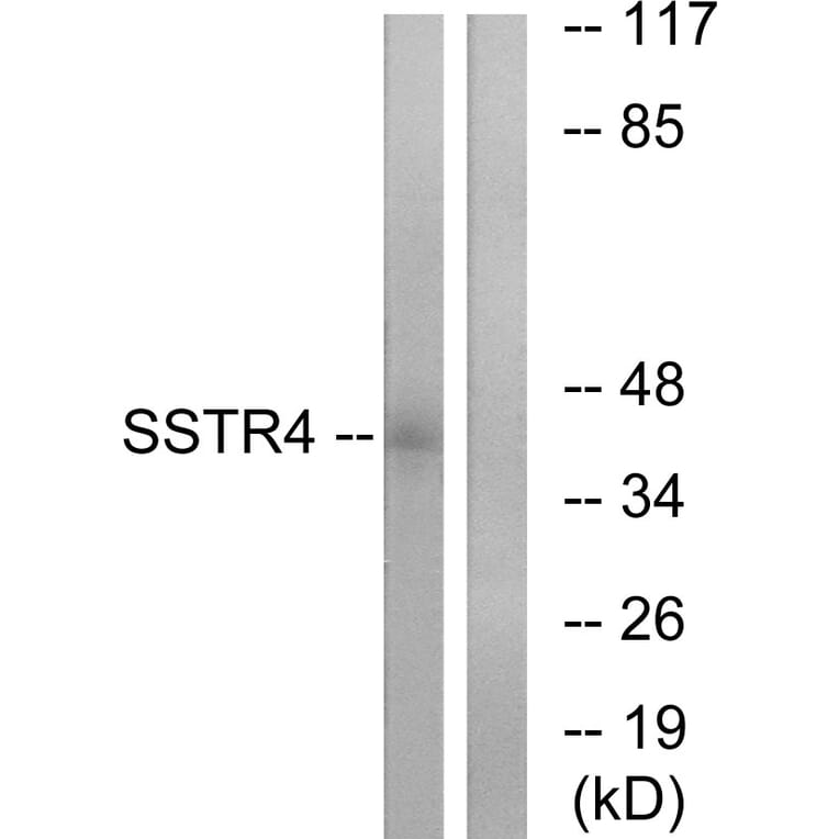 Western Blot - Anti-SSTR4 Antibody (G747) - Antibodies.com