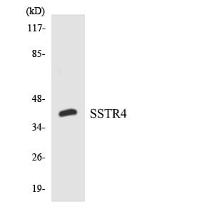 Western blot analysis of the lysates from HepG2 cells using Anti-SSTR4 Antibody.