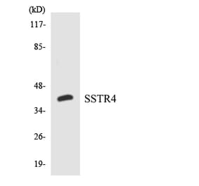 Western Blot - Anti-SSTR4 Antibody (R12-3565) - Antibodies.com