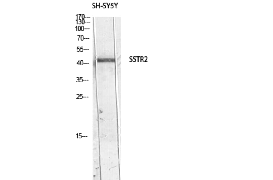 Western Blot - Anti-SSTR2 Antibody (C30261) - Antibodies.com