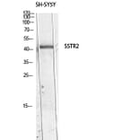Western Blot - Anti-SSTR2 Antibody (C30261) - Antibodies.com