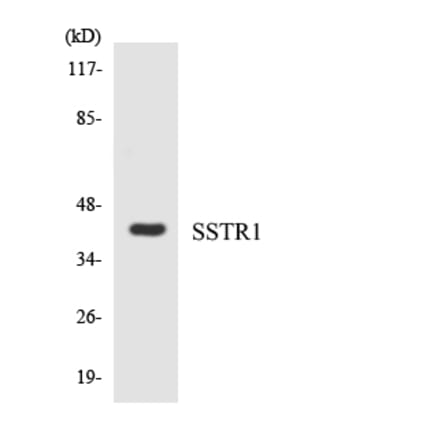 Western Blot - Anti-SSTR1 Antibody (R12-3564) - Antibodies.com