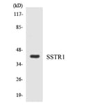 Western Blot - Anti-SSTR1 Antibody (R12-3564) - Antibodies.com
