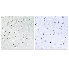 Immunohistochemistry - Anti-SSBP2 Antibody (C10803) - Antibodies.com