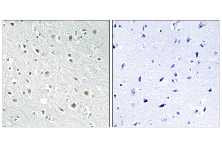 Immunohistochemistry - Anti-SSBP2 Antibody (C10803) - Antibodies.com
