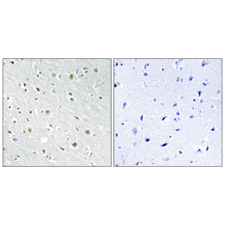 Immunohistochemistry - Anti-SSBP2 Antibody (C10803) - Antibodies.com